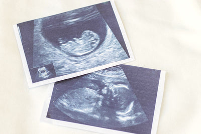懷孕初期注意事項 : 妳該知道的孕期小知識