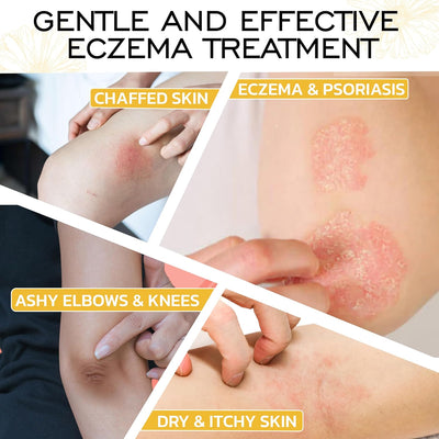 Satya Organic Eczema Relief